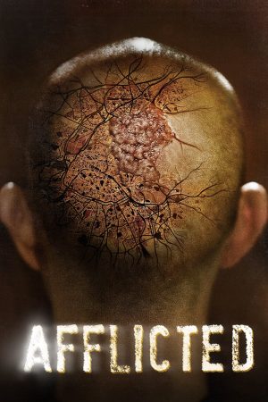 Phim Sức Mạnh Dị Thường - Afflicted PhimChill Vietsub (2014)